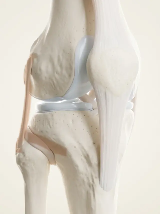 Anatomical render of the right knee, anterolateral view: femur and tibia in porcelain white with the patellar tendon and collateral ligaments exposed.